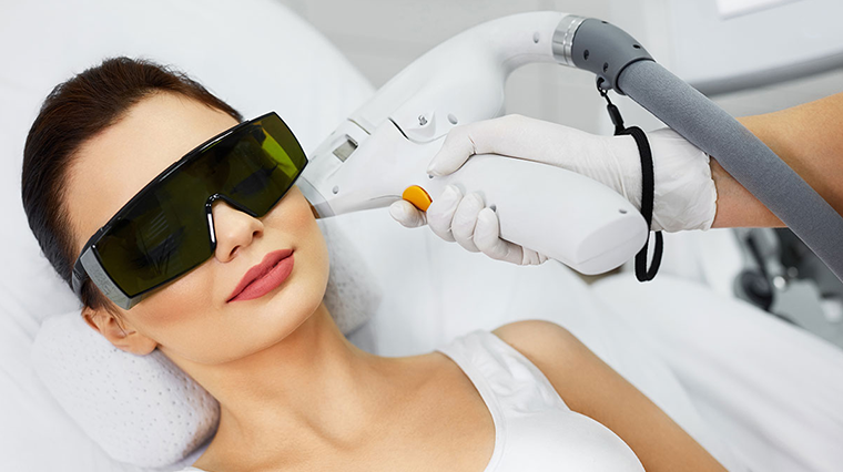 Epilazione Laser