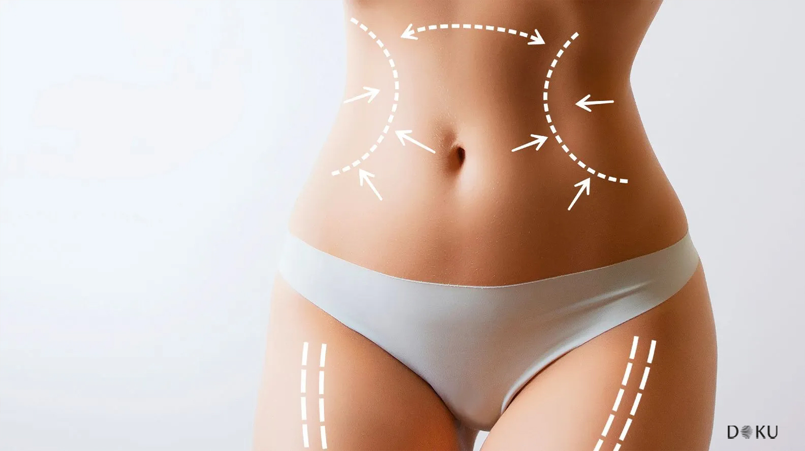 Liposuction