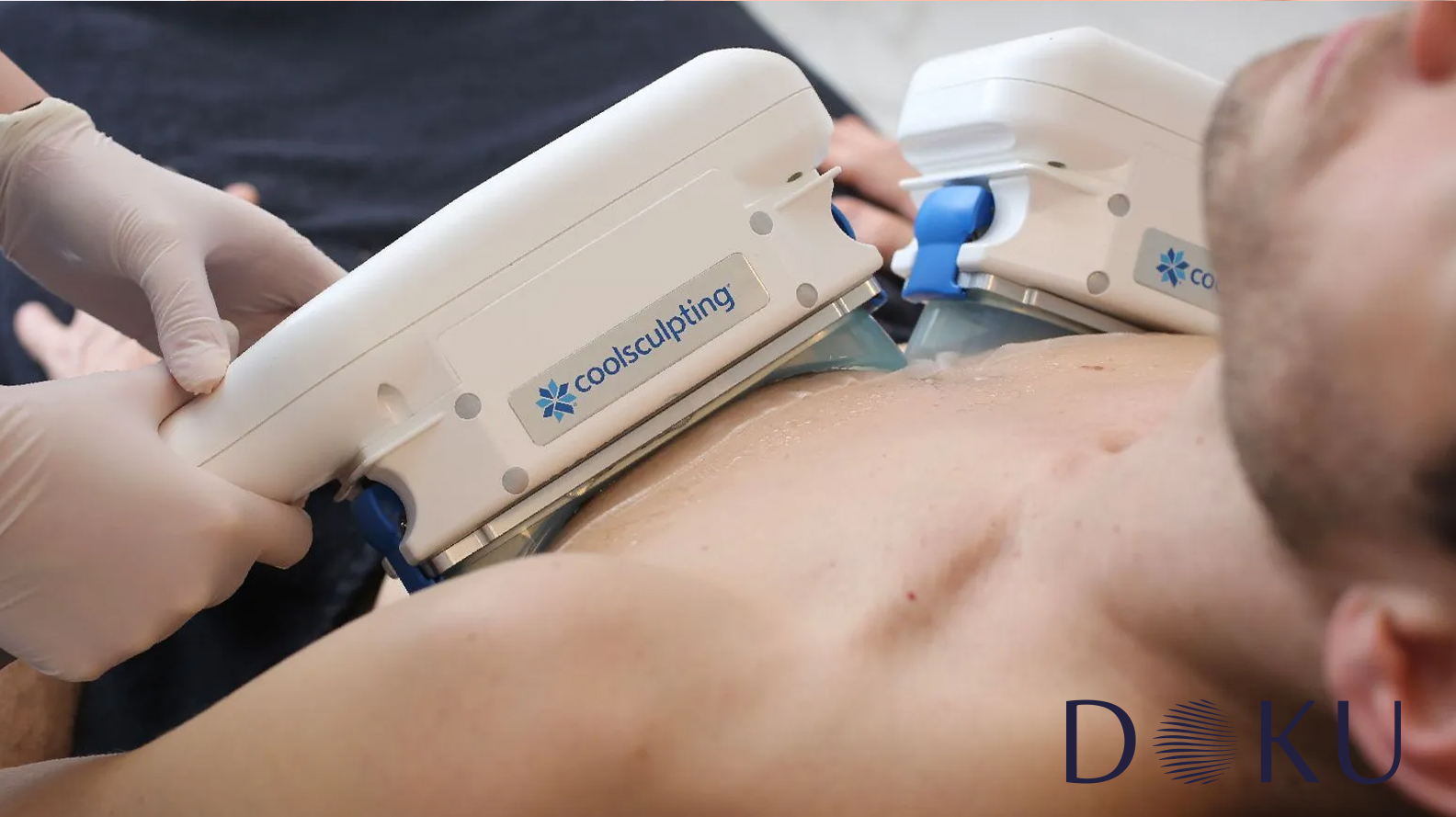 CoolSculpting – Soğuk Lipoliz