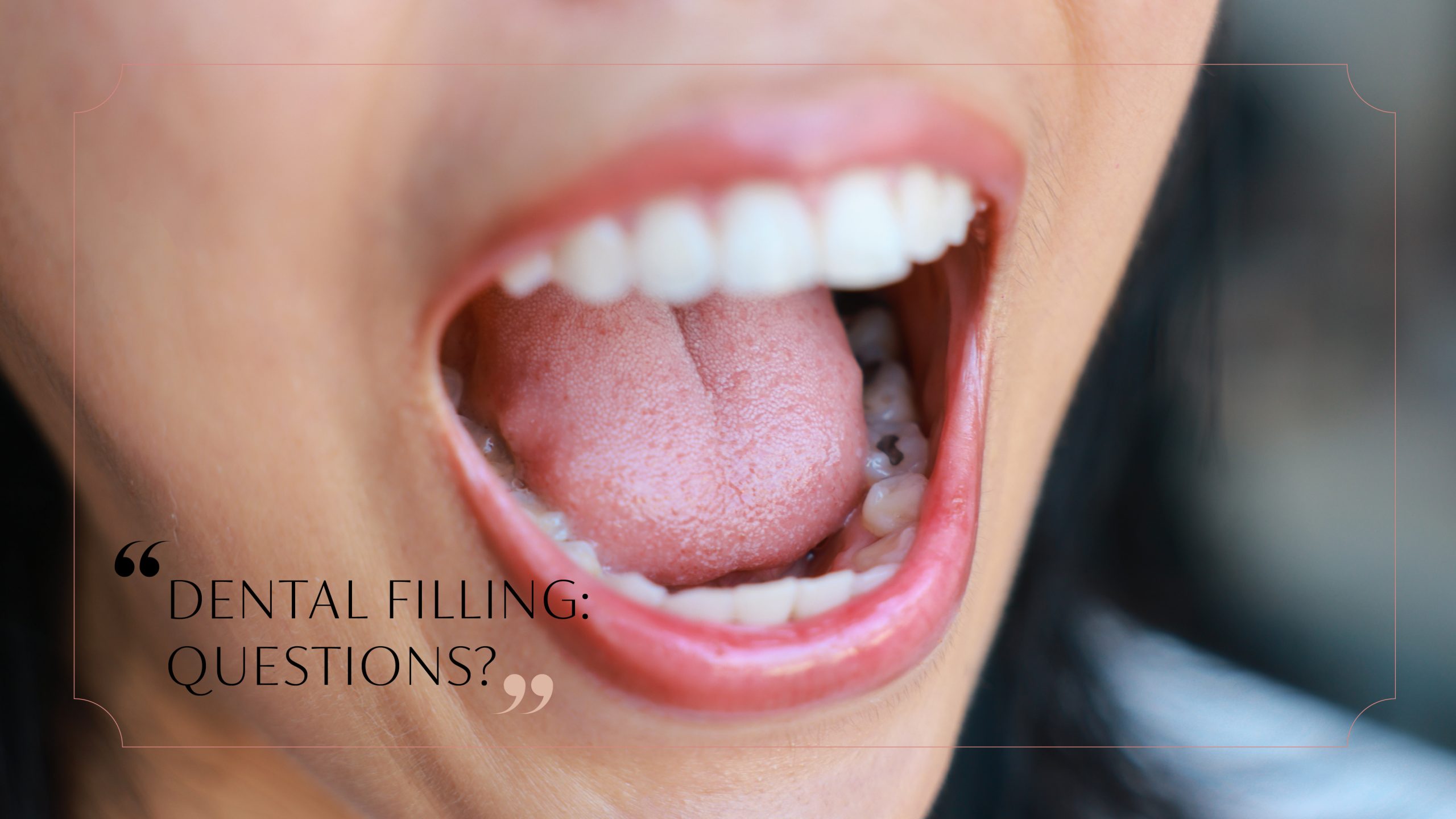 How to Tell If a Dental Filling Is Faulty ?